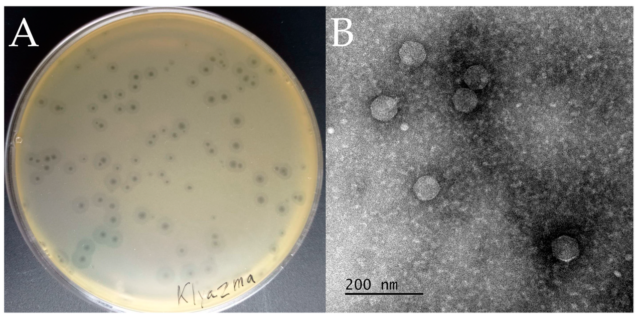 Imagen al microscopio de un bacteriófago